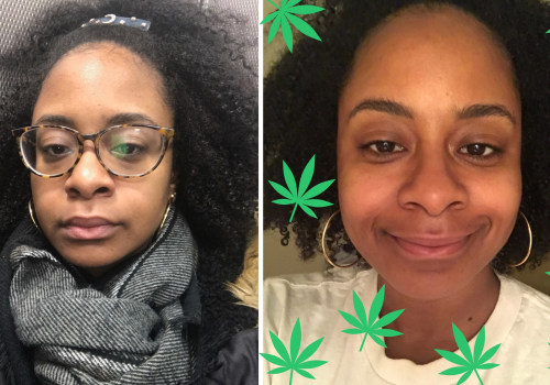 What happens if you put cbd on your face?
